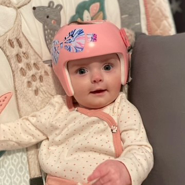 Baby Ava Cranial Helmet Plagiocephaly