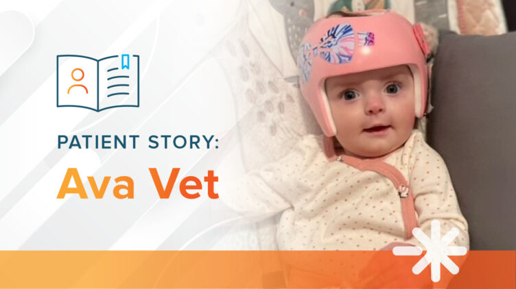 Ava Baby Plagiocephaly Cranial Helmet