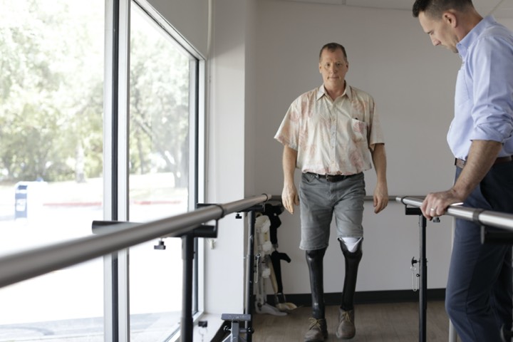 This Is What It's Like To Live With A Prosthetic Leg