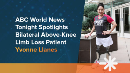 ABC World News Tonight Spotlights Bilateral Above-Knee Limb Loss Patient