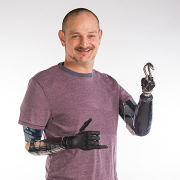 types of prosthetic arms